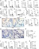 Caspase 1 (Cleaved Asp210) Antibody in Immunohistochemistry (Paraffin) (IHC (P))