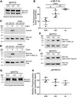 Phospho-MYL2 (Ser15) Antibody in Western Blot (WB)