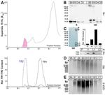 TFF2 Antibody in Western Blot (WB)