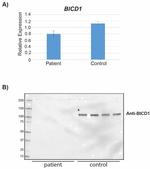 BICD1 Antibody in Western Blot (WB)