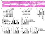 Collagen II Antibody in Western Blot (WB)