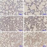 NOTCH1 Antibody in Immunohistochemistry (Paraffin) (IHC (P))