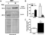 Citrate Synthase Antibody in Western Blot (WB)