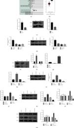 DDX17 Antibody in Western Blot (WB)