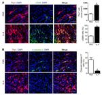 CD90 (Thy-1) Antibody in Immunohistochemistry (IHC)