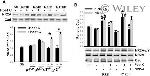 Phosphotyrosine Antibody in Western Blot (WB)