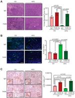 CD8a Antibody in Immunohistochemistry (IHC)