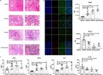 CD8a Antibody in Immunohistochemistry (IHC)