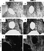 Collagen II Antibody in Immunohistochemistry (IHC)