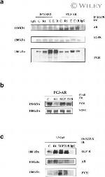 Androgen Receptor Antibody in Immunoprecipitation (IP)