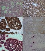 CCKBR Antibody in Immunohistochemistry (IHC)