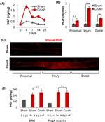 HGF Antibody