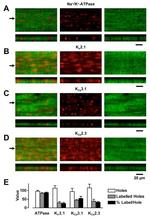 ATP1A3 Antibody in Immunohistochemistry (IHC)