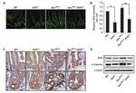 beta Catenin Antibody in Immunohistochemistry (IHC)