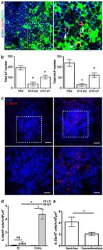 CD45R Antibody in Immunohistochemistry (IHC)