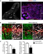 NFATC4 Antibody in Immunocytochemistry, Immunohistochemistry (ICC/IF, IHC)