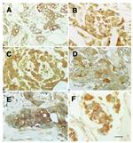 MMP13 Antibody in Immunohistochemistry (IHC)