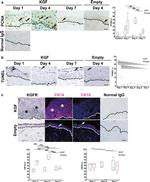 FGFR2 Antibody in Immunohistochemistry (IHC)