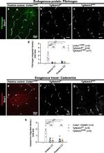 GLUT1 Antibody in Immunohistochemistry (IHC)