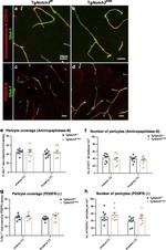 GLUT1 Antibody in Immunohistochemistry (IHC)