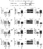 TPM1 Antibody in Western Blot (WB)