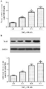 DKK2 Antibody in Western Blot (WB)