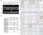 SLC5A5 Antibody in Immunohistochemistry (IHC)