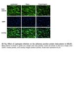 beta Catenin Antibody in Immunocytochemistry (ICC/IF)