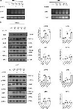 Phospho-PERK (Thr982) Antibody in Western Blot (WB)