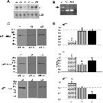 ATP1A3 Antibody in Western Blot (WB)