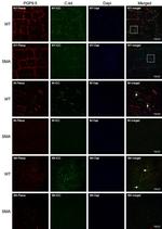 c-Kit Antibody in Immunocytochemistry (ICC/IF)