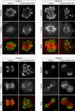 alpha Tubulin Antibody in Immunocytochemistry, Immunohistochemistry (ICC/IF, IHC)