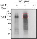 ALG1 Antibody in Immunoprecipitation (IP)