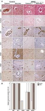 ZO-1 Antibody in Immunohistochemistry (IHC)