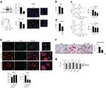 Collagen II Antibody in Immunocytochemistry, Immunohistochemistry (ICC/IF, IHC)