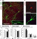 c-Fos Antibody in Immunohistochemistry (IHC)