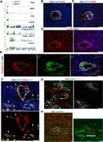 Thrombospondin 1 Antibody in Immunohistochemistry (IHC)