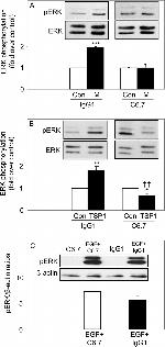 Thrombospondin 1 Antibody in Western Blot (WB)