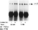 Phosphotyrosine Antibody in Western Blot (WB)