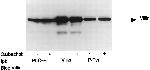 Phosphotyrosine Antibody in Immunoprecipitation (IP)