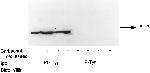 Phosphotyrosine Antibody in Immunoprecipitation (IP)