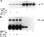 Phosphotyrosine Antibody in Western Blot (WB)