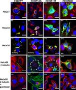 Connexin 26 Antibody in Immunocytochemistry (ICC/IF)