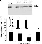 GnRHR Antibody in Western Blot (WB)