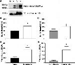 LOX Antibody in Western Blot (WB)