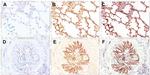 Cytokeratin Pan Antibody in Immunohistochemistry (IHC)