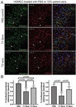 VE-cadherin Antibody in Immunocytochemistry (ICC/IF)