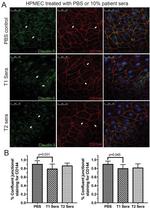 VE-cadherin Antibody in Immunocytochemistry (ICC/IF)