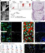 Collagen II Antibody in Immunohistochemistry (IHC)