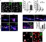 P-cadherin Antibody in Immunohistochemistry (IHC)